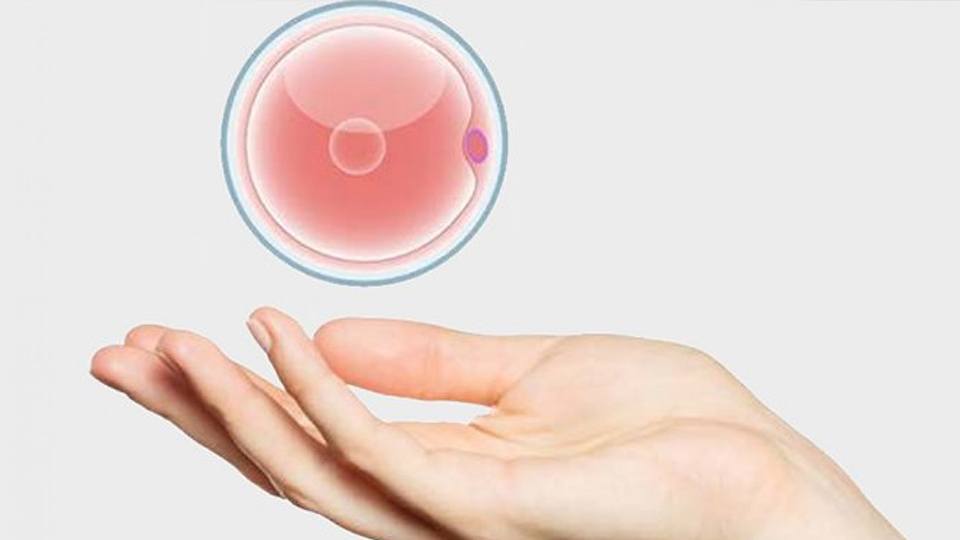 ЕКЗ з донорськими яйцеклітинами: коли це єдиний шанс стати батьками